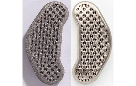 Inovatec Machinery 후처리 3D 부품 마무리 3D 의료용 임플란트